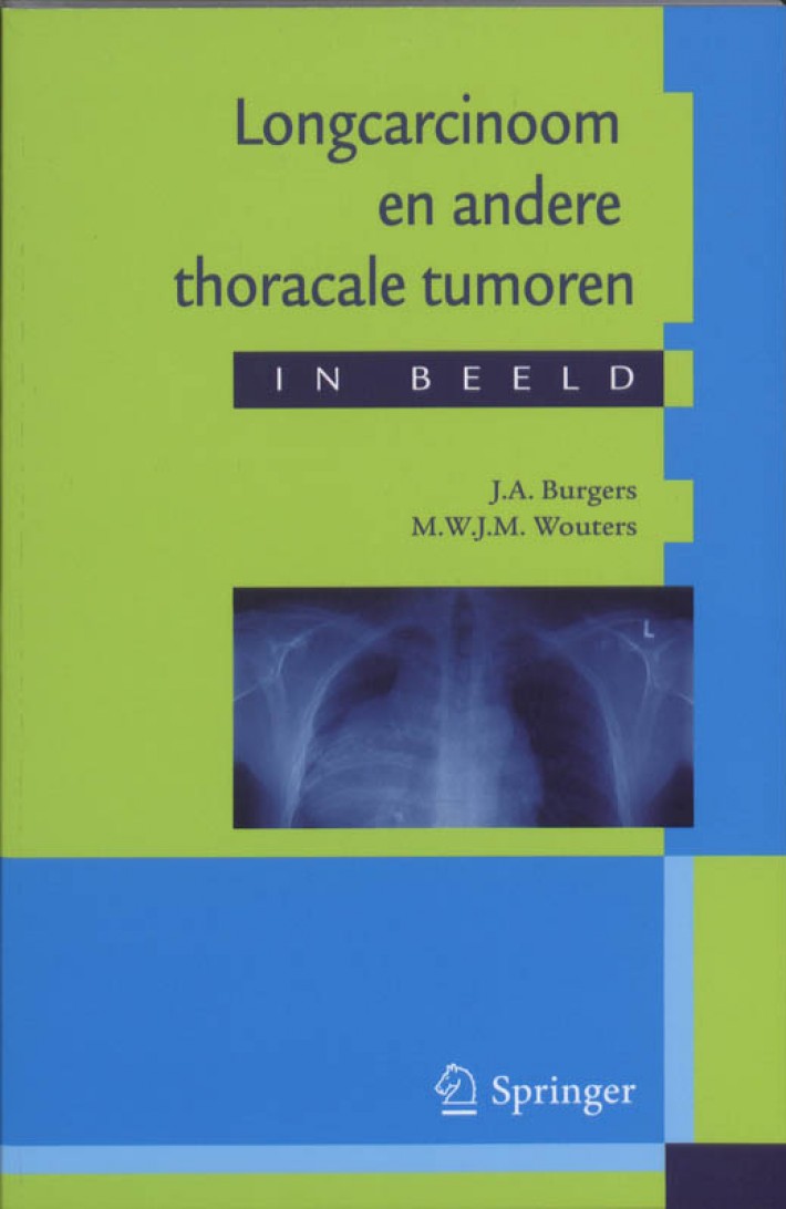 Longcarcinoom en andere thoracale tumoren