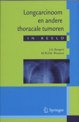 Longcarcinoom en andere thoracale tumoren