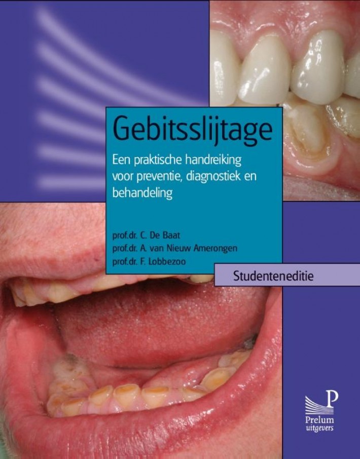 Gebitsslijtage