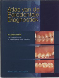 Atlas van de parodontale diagnostiek