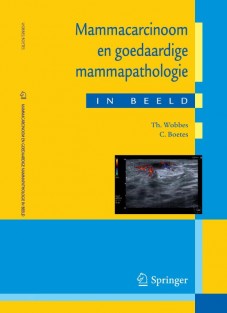 Mammacarcinoom en goedaardige mammapathologie in beeld • Mammacarcinoom en goedaardige mammapathologie in beeld