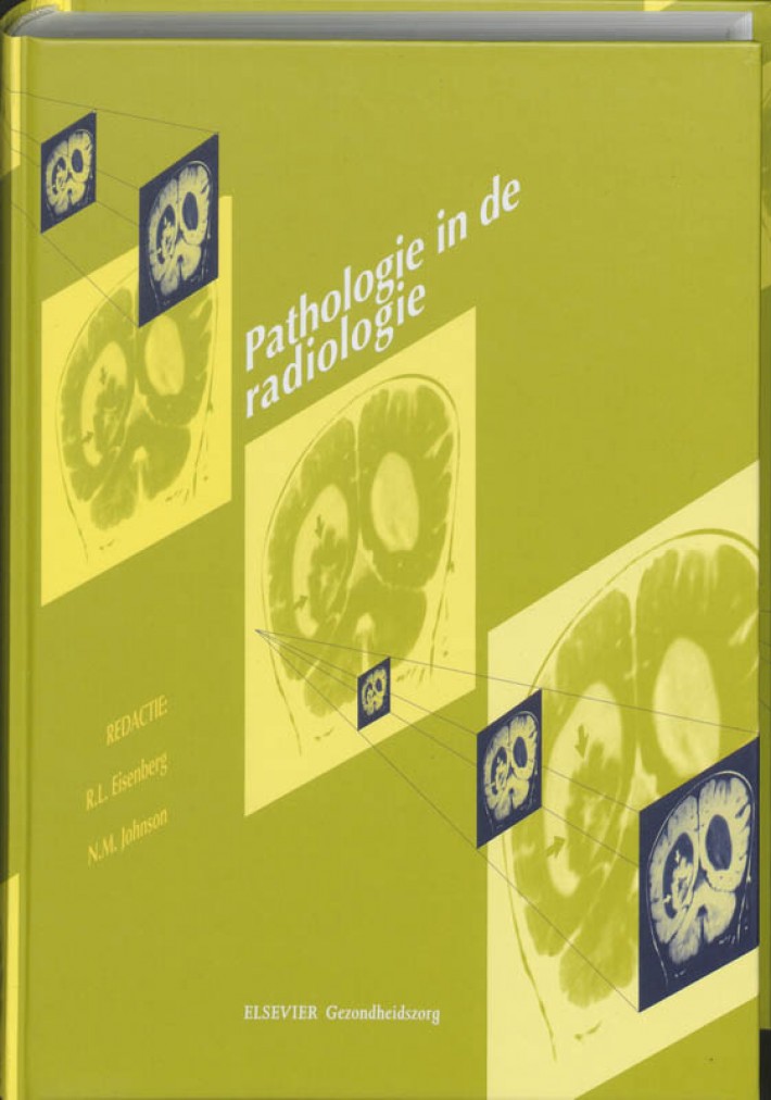 Pathologie in de Radiologie • Pathologie in de radiologie