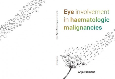 Eye involvement in haematological malignancies