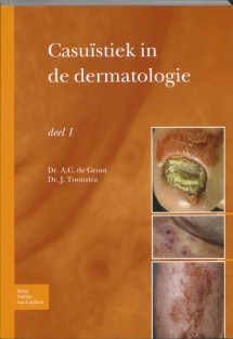Casuïstiek in de dermatologie