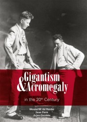 Gigantism & Acromegaly