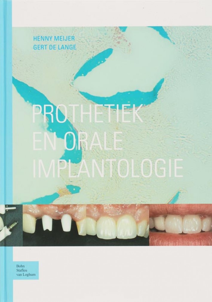 Prothetiek en orale implantologie