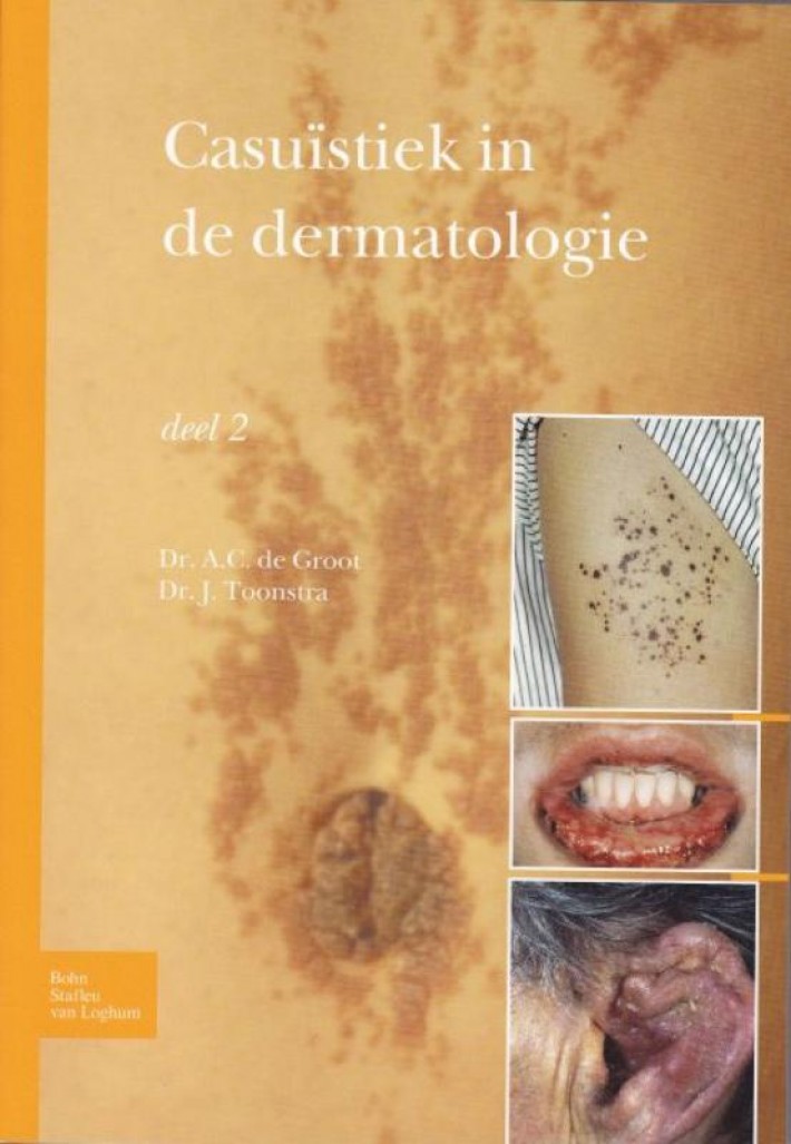 Casuïstiek in de dermatologie • Casuïstiek in de dermatologie