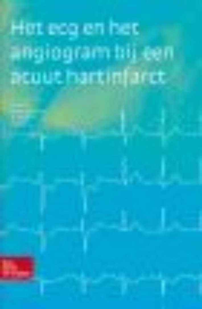 Het ECG en het angiogram bij een acuut hartinfarct