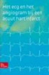 Het ECG en het angiogram bij een acuut hartinfarct