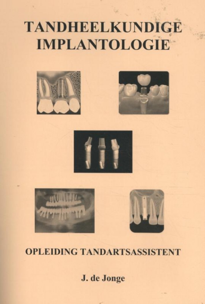 Tandheelkundige Implantologie