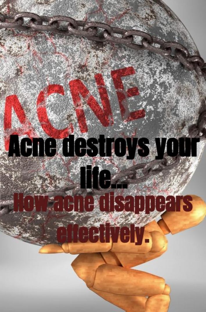 Acne destroys your life...