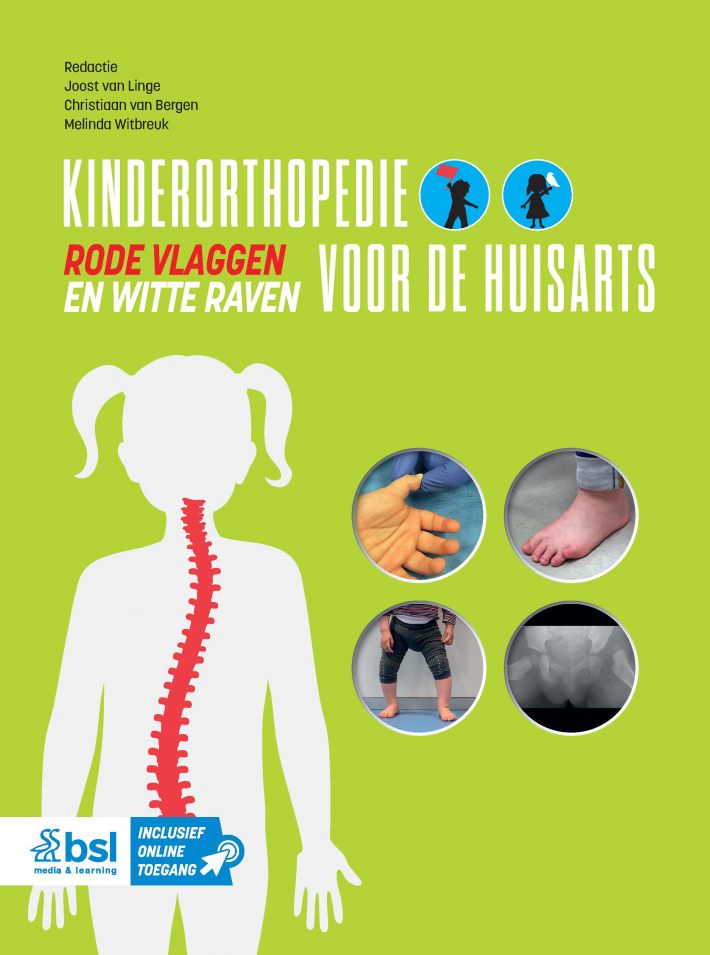 Kinderorthopedie voor de huisarts