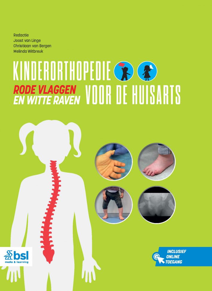 Kinderorthopedie voor de huisarts