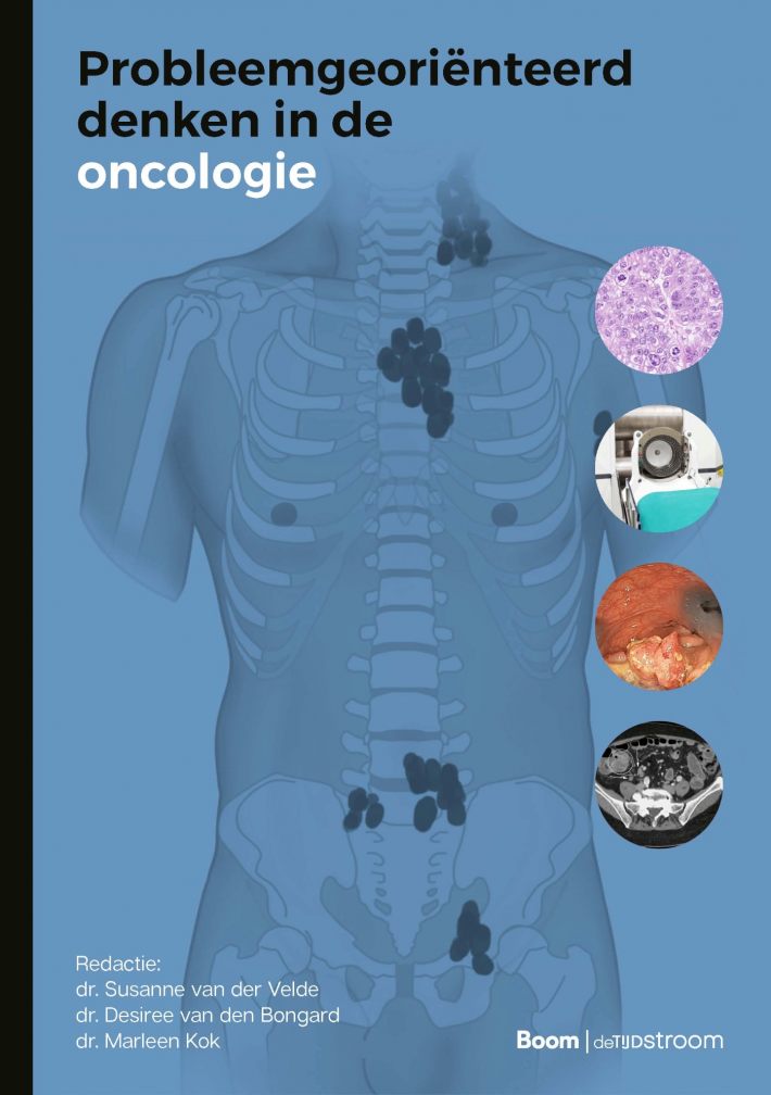 Probleemgeoriënteerd denken in de oncologie