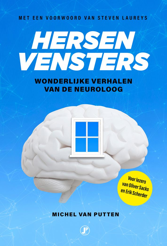 Hersenvensters