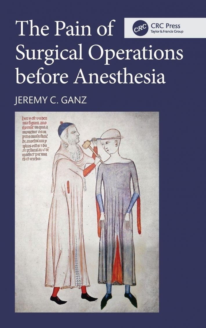 The Pain of Surgical Operations before Anesthesia