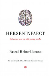 Herseninfarct Herseninfarct